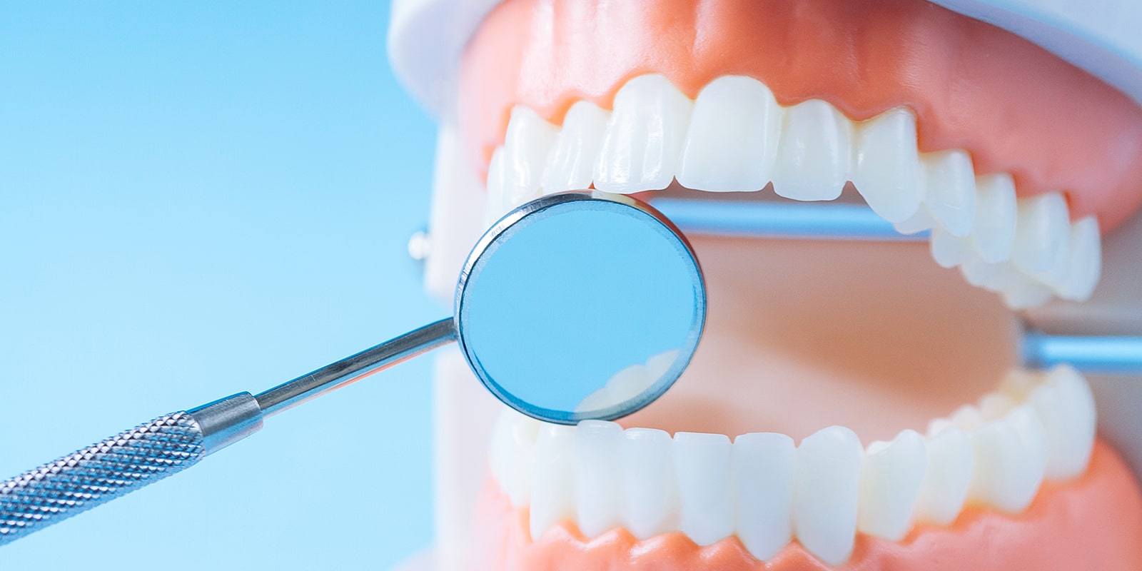 歯のクリーニング・定期検診